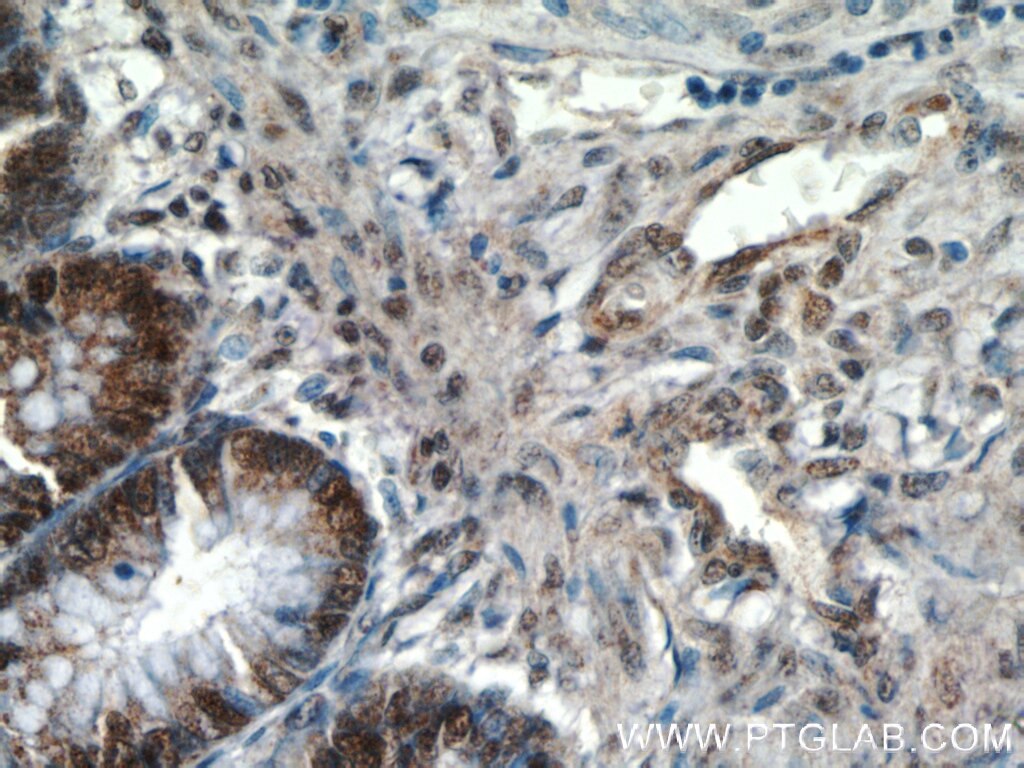 Immunohistochemistry (IHC) staining of human colon tissue using LEO1 Polyclonal antibody (12281-1-AP)