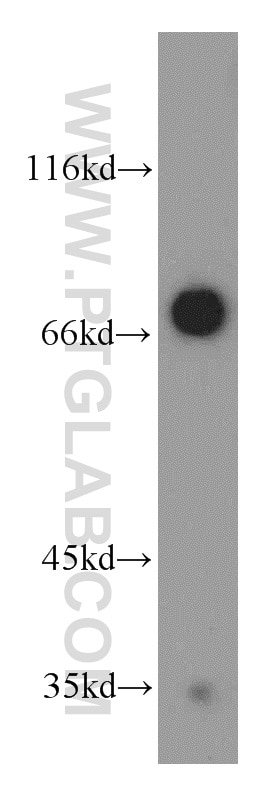 Western Blot (WB) analysis of mouse heart tissue using LEO1 Polyclonal antibody (12281-1-AP)