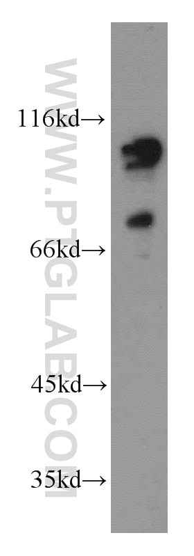 Western Blot (WB) analysis of HeLa cells using LEO1 Polyclonal antibody (12281-1-AP)