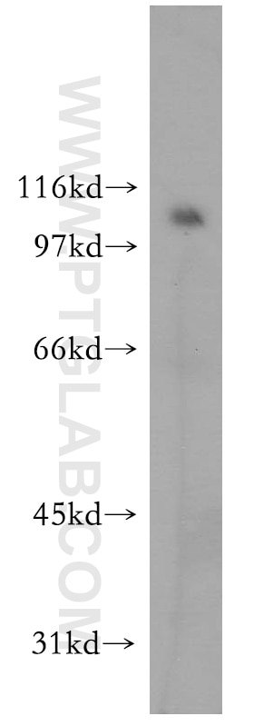 WB analysis of Jurkat using 12281-1-AP