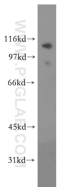 Western Blot (WB) analysis of mouse brain tissue using LEO1 Polyclonal antibody (12281-1-AP)