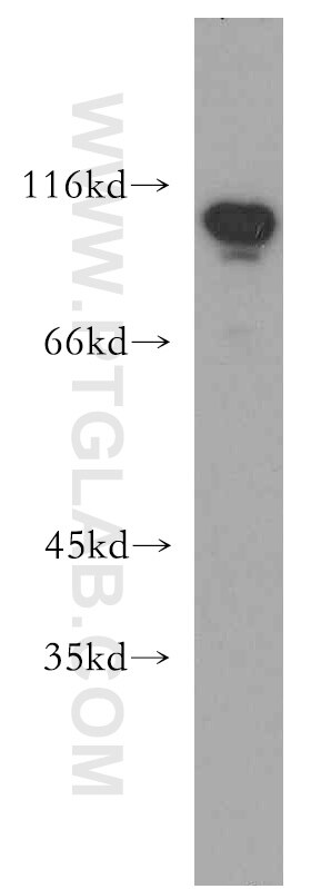 WB analysis of HeLa using 12281-1-AP