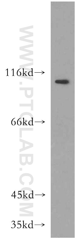 Western Blot (WB) analysis of mouse heart tissue using LEO1 Polyclonal antibody (12281-1-AP)