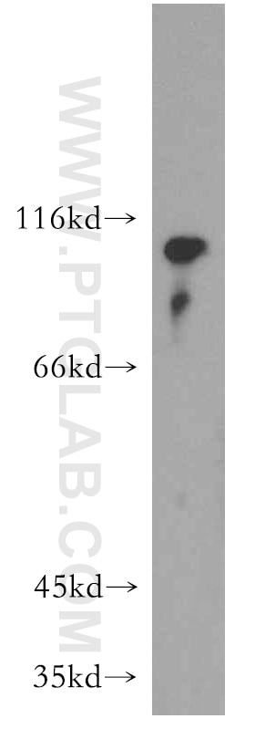 Western Blot (WB) analysis of human placenta tissue using LEO1 Polyclonal antibody (12281-1-AP)