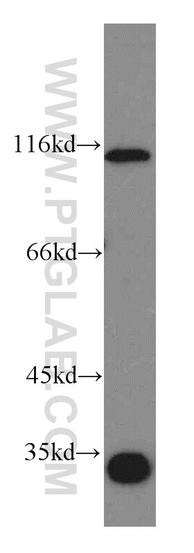 Western Blot (WB) analysis of mouse skeletal muscle tissue using LEO1 Polyclonal antibody (12281-1-AP)