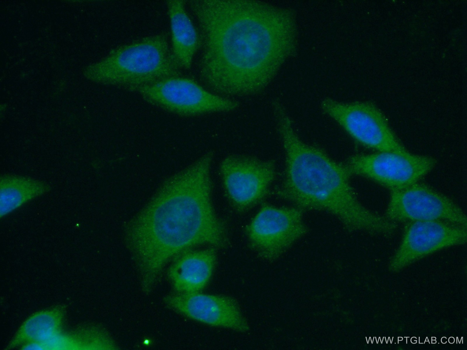 Immunofluorescence (IF) / fluorescent staining of HeLa cells using Leptin Polyclonal antibody (17436-1-AP)