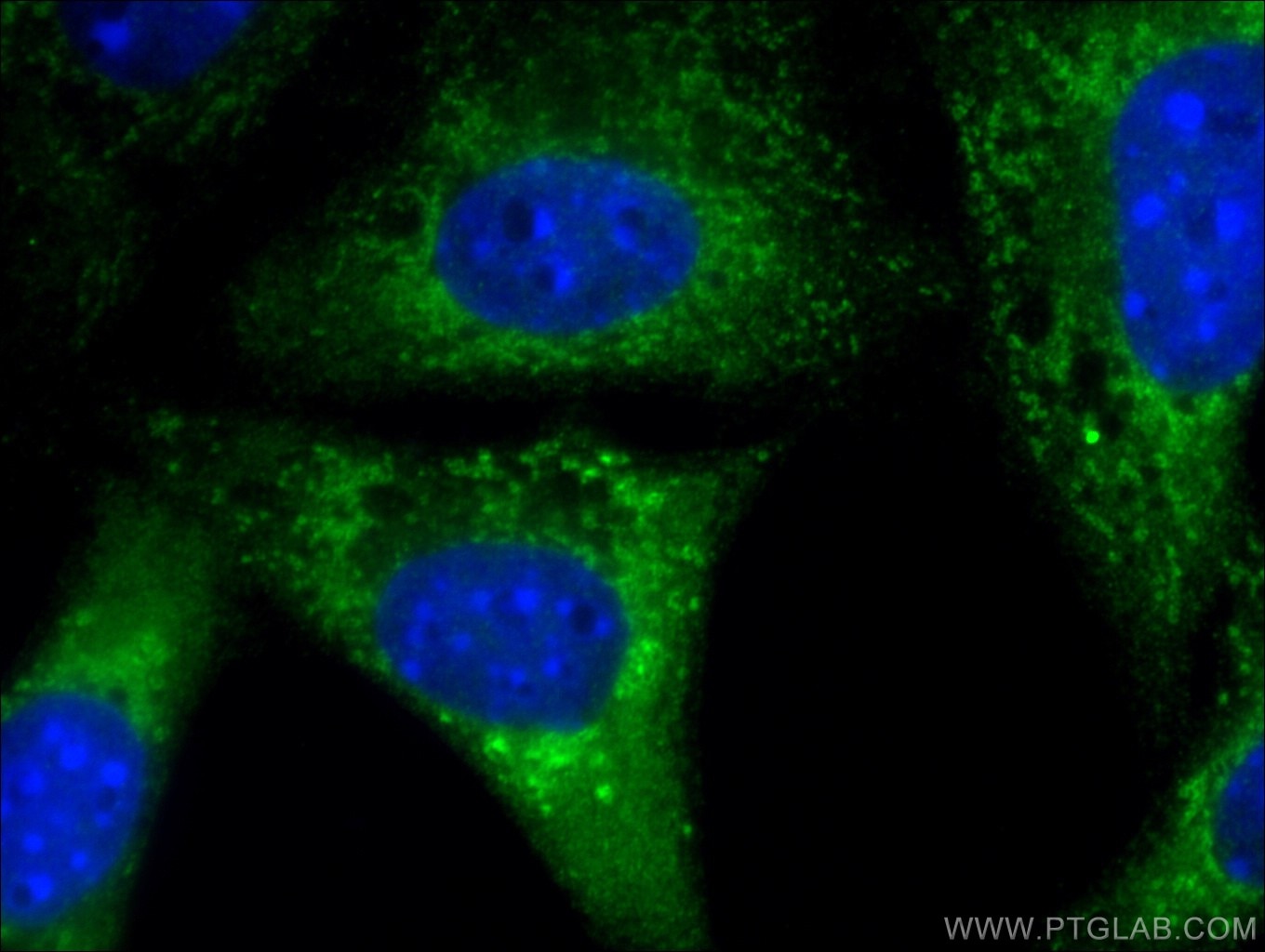 Immunofluorescence (IF) / fluorescent staining of NIH/3T3 cells using Leptin Polyclonal antibody (17436-1-AP)