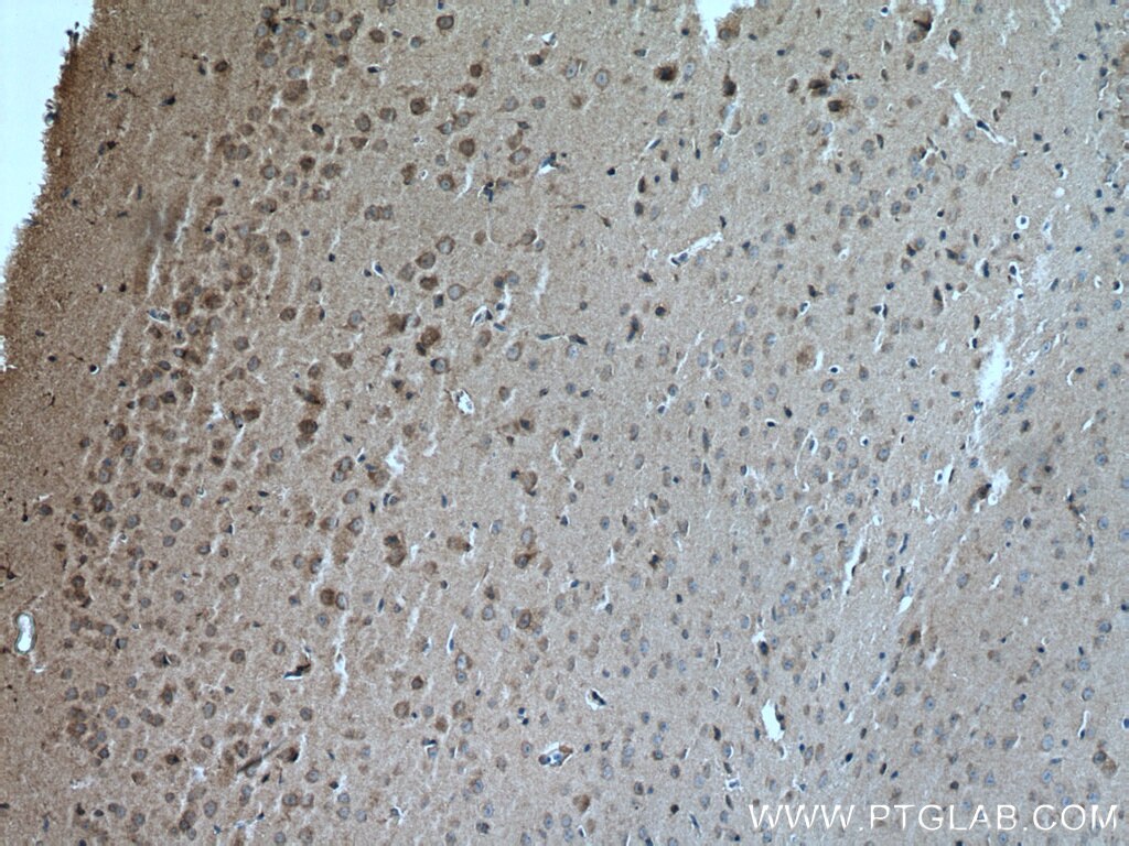 Immunohistochemistry (IHC) staining of mouse brain tissue using Leptin Polyclonal antibody (17436-1-AP)