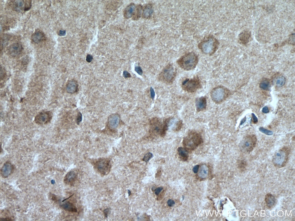 Immunohistochemistry (IHC) staining of mouse brain tissue using Leptin Polyclonal antibody (17436-1-AP)