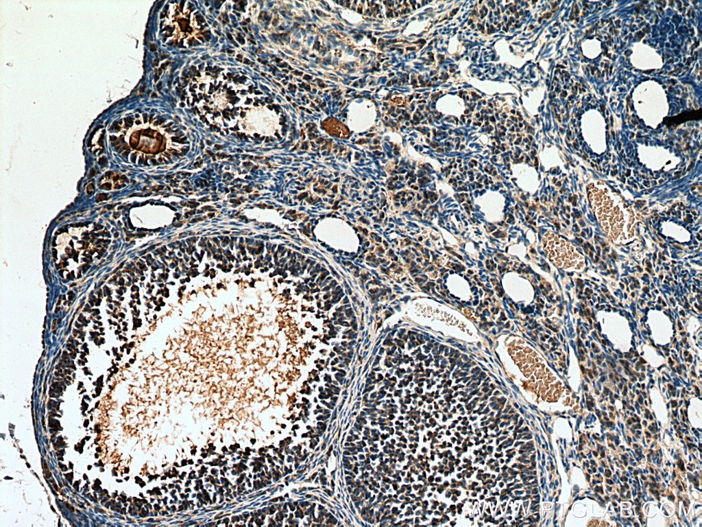 Immunohistochemistry (IHC) staining of mouse ovary tissue using Leptin Polyclonal antibody (17436-1-AP)