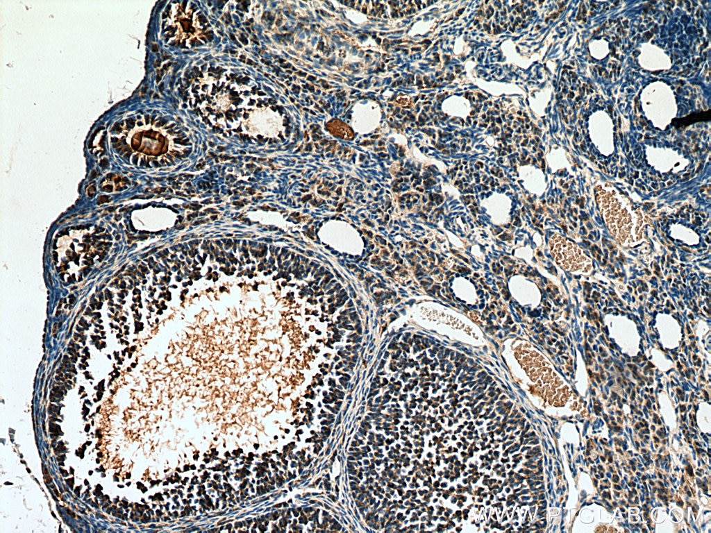 IHC staining of mouse ovary using 17436-1-AP