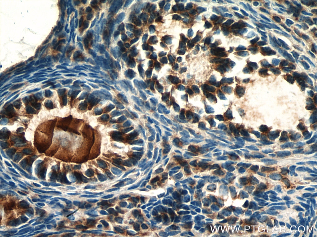 Immunohistochemistry (IHC) staining of mouse ovary tissue using Leptin Polyclonal antibody (17436-1-AP)