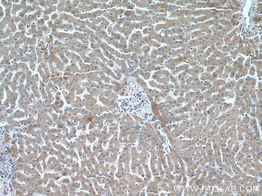 Immunohistochemistry (IHC) staining of human liver tissue using Leptin Polyclonal antibody (17436-1-AP)