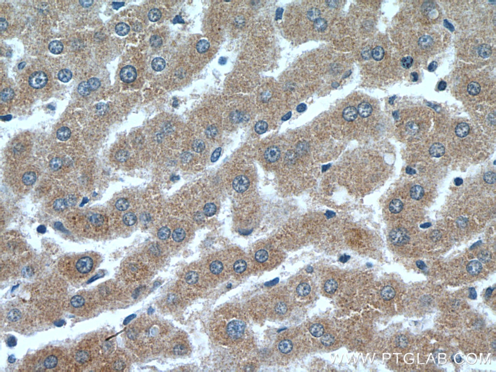 Immunohistochemistry (IHC) staining of human liver tissue using Leptin Polyclonal antibody (17436-1-AP)