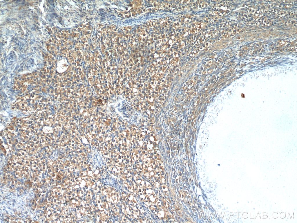 Immunohistochemistry (IHC) staining of human ovary tissue using Leptin Polyclonal antibody (17436-1-AP)