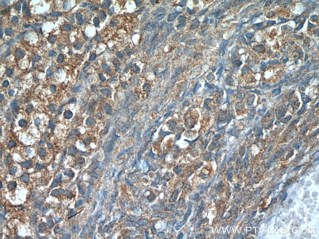 Immunohistochemistry (IHC) staining of human ovary tissue using Leptin Polyclonal antibody (17436-1-AP)