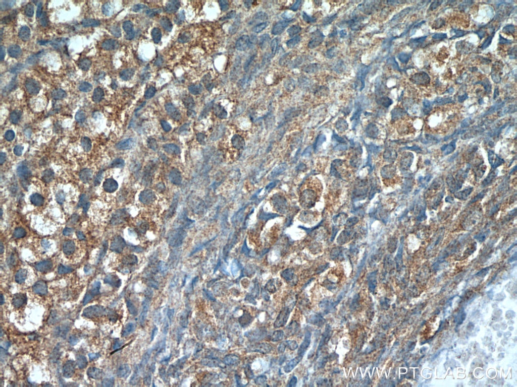 IHC staining of human ovary using 17436-1-AP