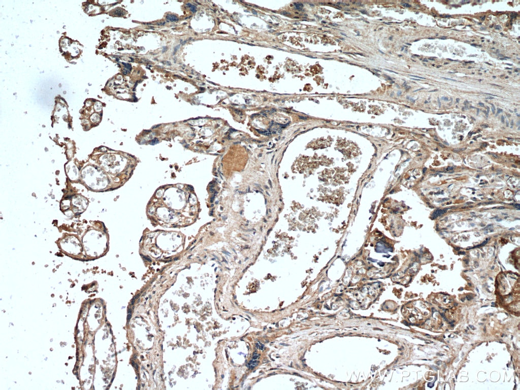 Immunohistochemistry (IHC) staining of human placenta tissue using Leptin Polyclonal antibody (17436-1-AP)