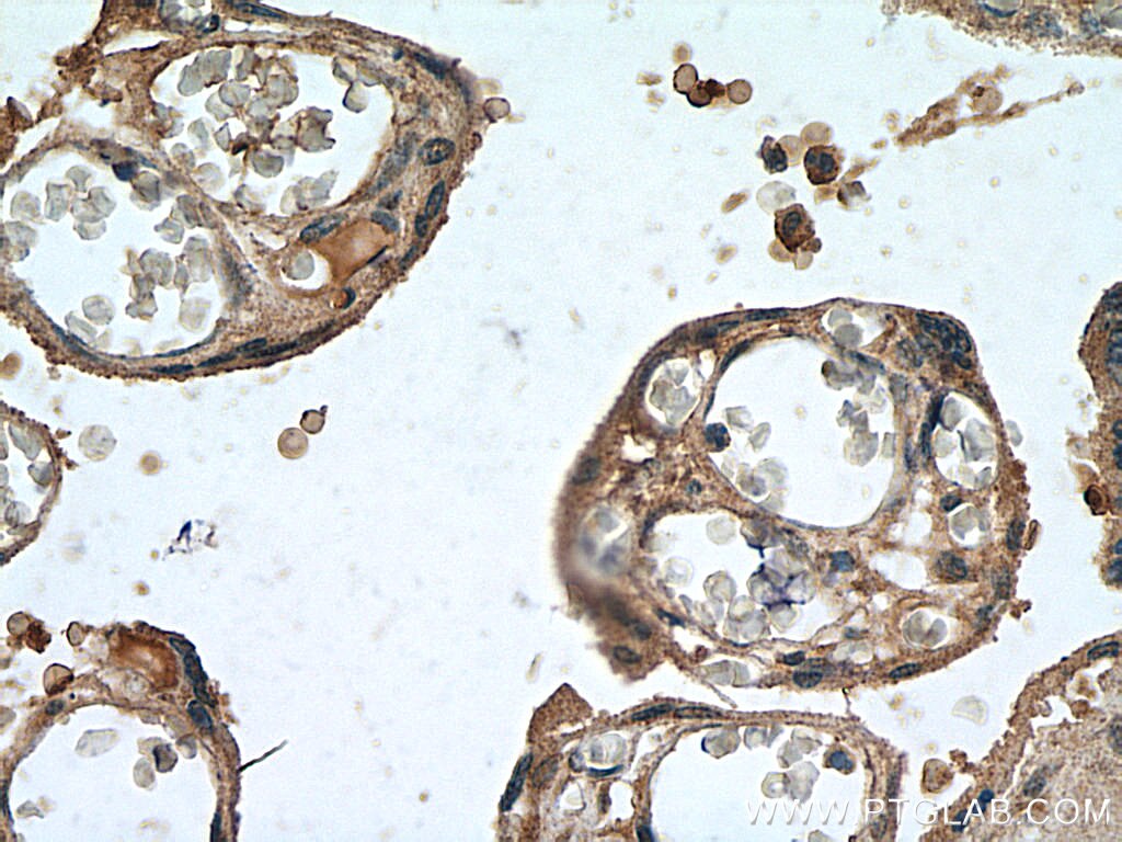 Immunohistochemistry (IHC) staining of human placenta tissue using Leptin Polyclonal antibody (17436-1-AP)