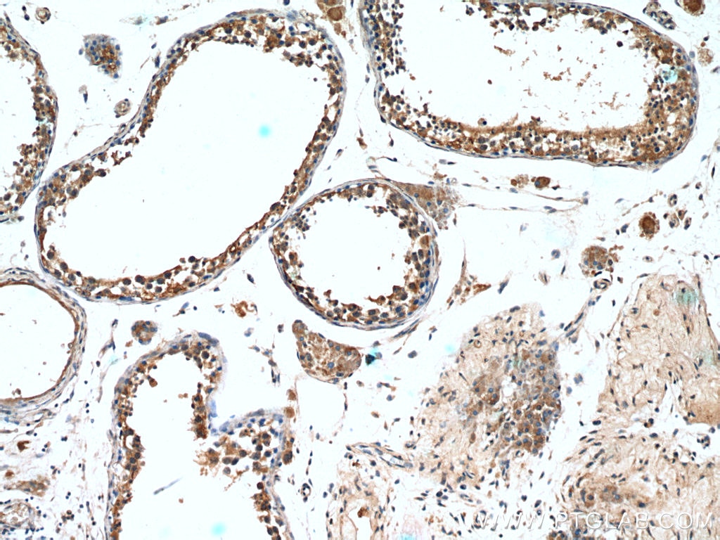 Immunohistochemistry (IHC) staining of human testis tissue using Leptin Polyclonal antibody (17436-1-AP)