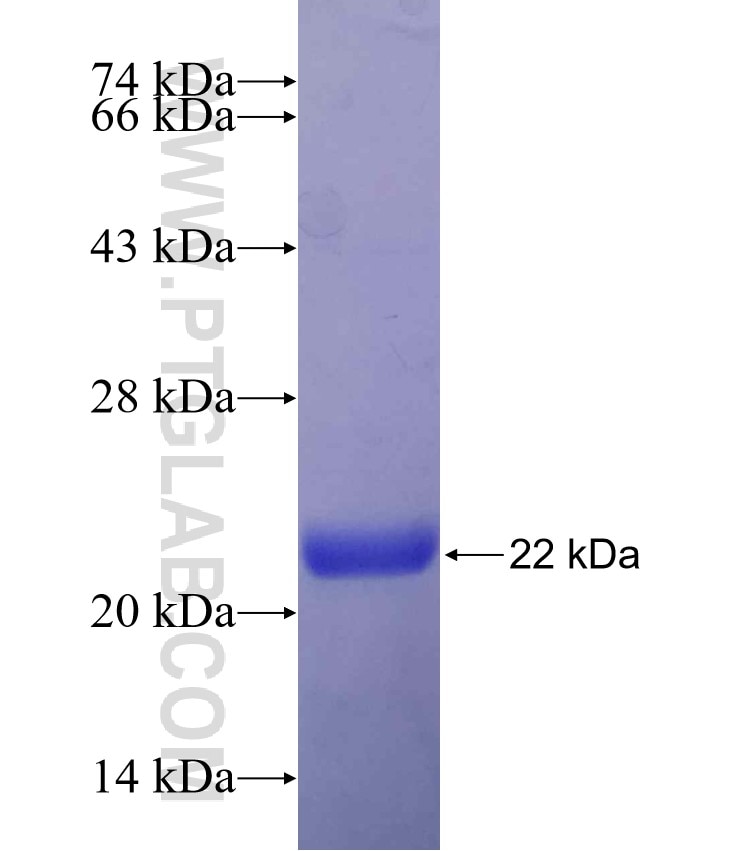 LEP fusion protein Ag11475 SDS-PAGE