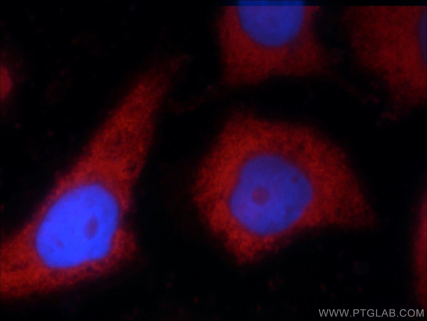 Immunofluorescence (IF) / fluorescent staining of MCF-7 cells using LEPR Polyclonal antibody (20966-1-AP)