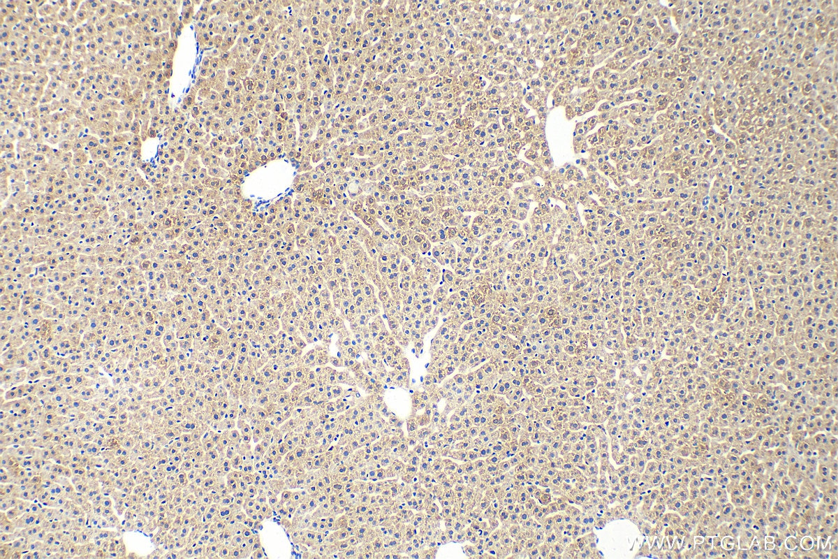 Immunohistochemistry (IHC) staining of mouse liver tissue using LEPR Polyclonal antibody (20966-1-AP)