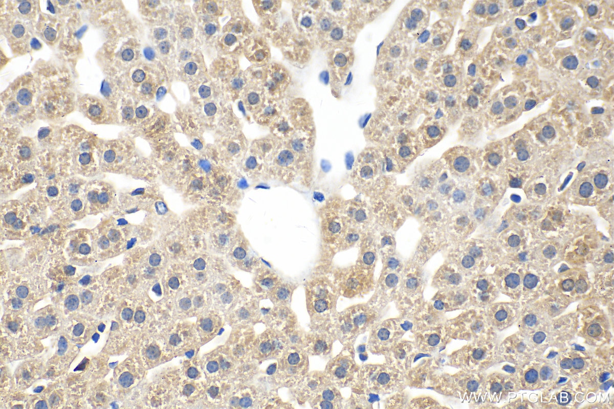 Immunohistochemistry (IHC) staining of mouse liver tissue using LEPR Polyclonal antibody (20966-1-AP)