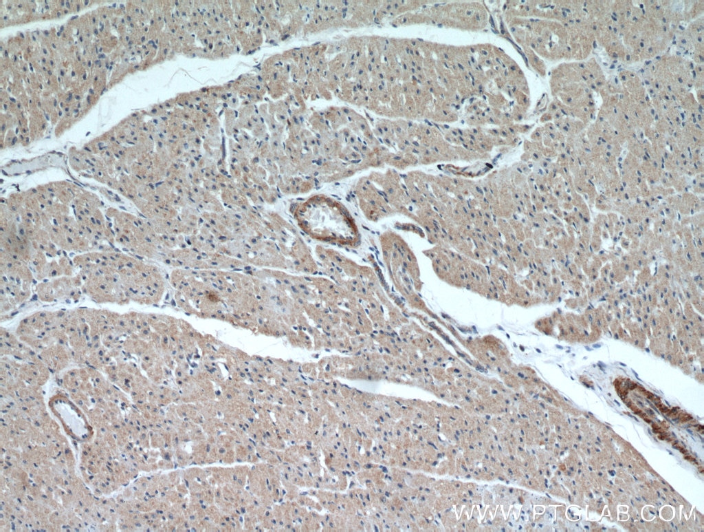 IHC staining of human heart using 20966-1-AP