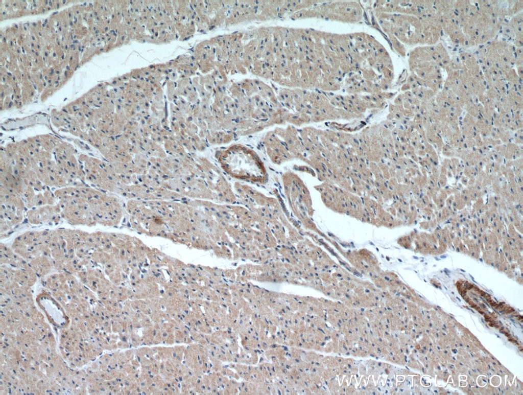 Immunohistochemistry (IHC) staining of human heart tissue using LEPR Polyclonal antibody (20966-1-AP)