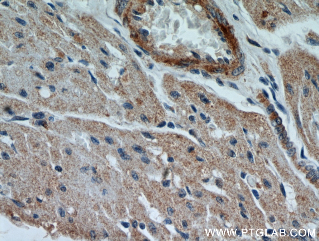 Immunohistochemistry (IHC) staining of human heart tissue using LEPR Polyclonal antibody (20966-1-AP)