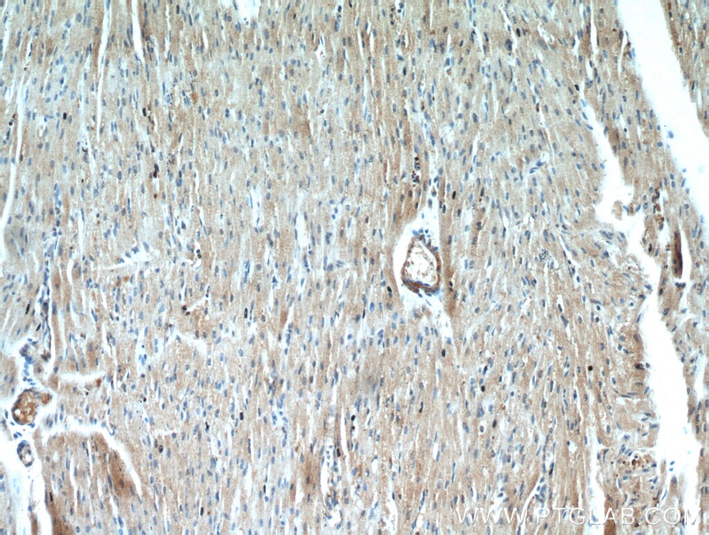 Immunohistochemistry (IHC) staining of human heart tissue using LEPR Polyclonal antibody (20966-1-AP)