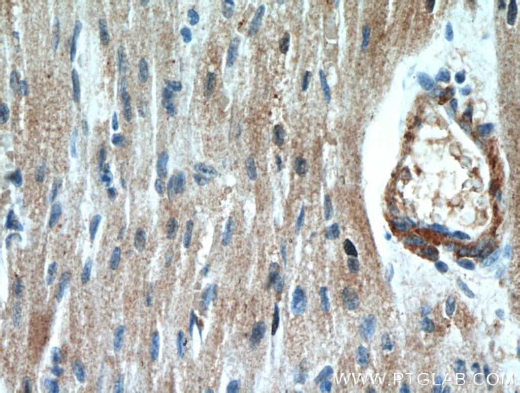 Immunohistochemistry (IHC) staining of human heart tissue using LEPR Polyclonal antibody (20966-1-AP)