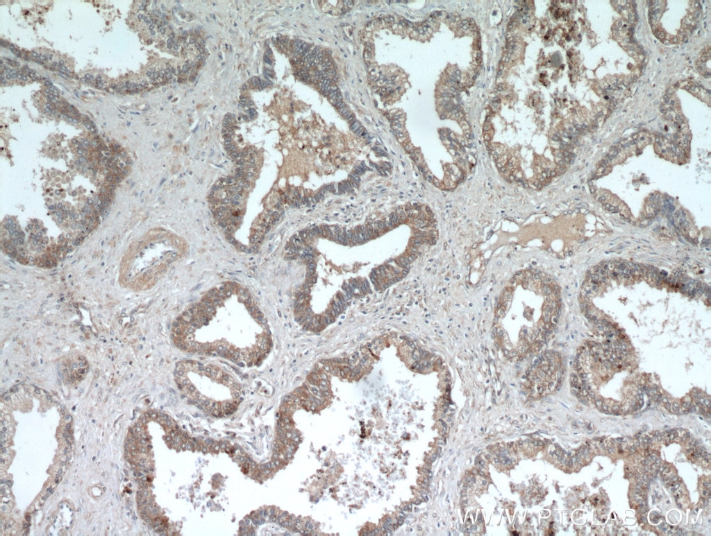 Immunohistochemistry (IHC) staining of human prostate hyperplasia tissue using LEPR Polyclonal antibody (20966-1-AP)