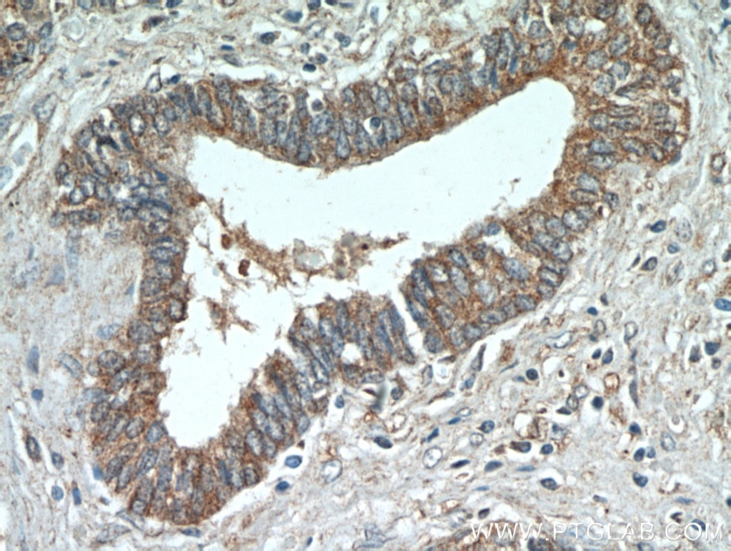 Immunohistochemistry (IHC) staining of human prostate hyperplasia tissue using LEPR Polyclonal antibody (20966-1-AP)