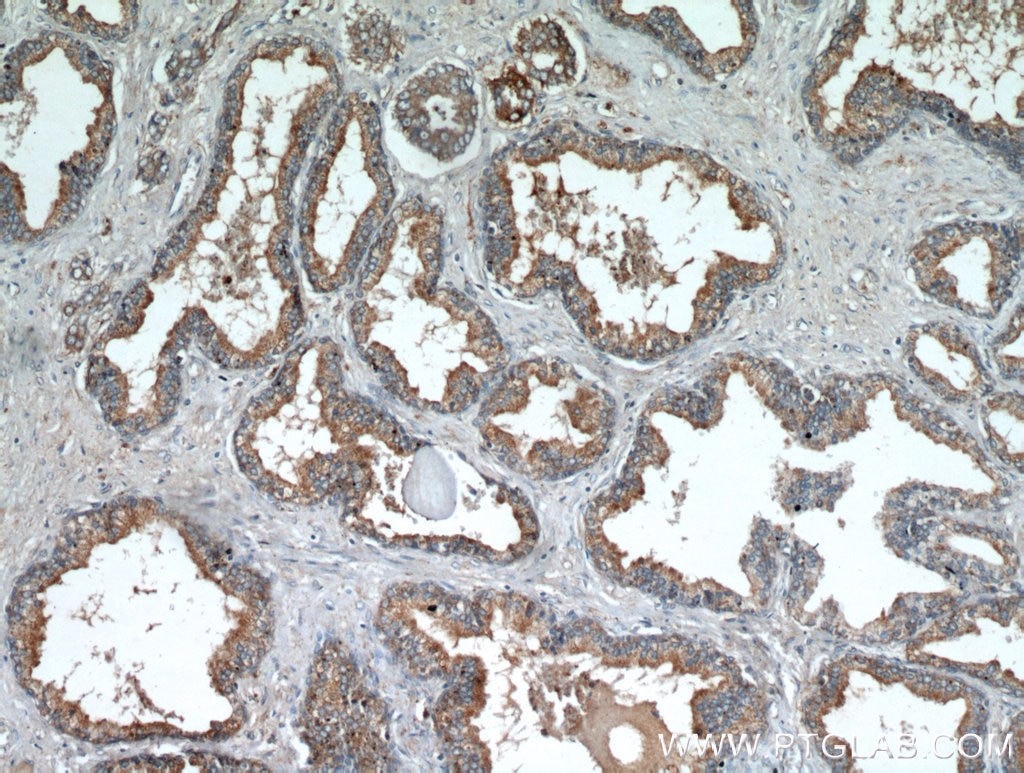 Immunohistochemistry (IHC) staining of human prostate hyperplasia tissue using LEPR Polyclonal antibody (20966-1-AP)