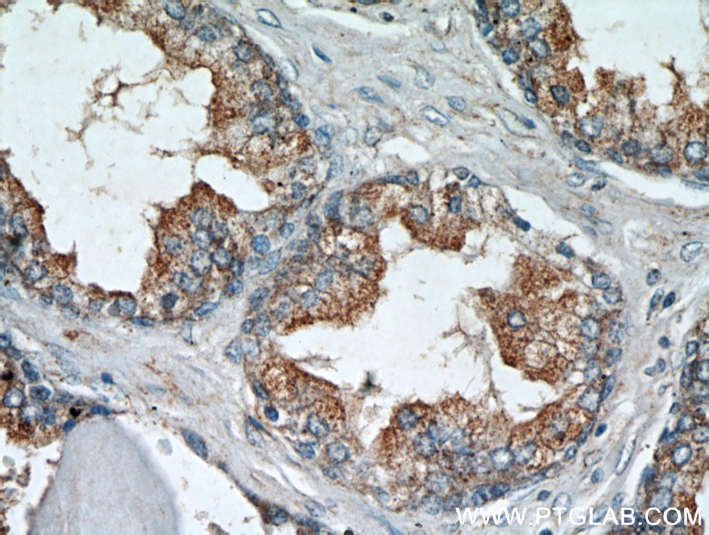 Immunohistochemistry (IHC) staining of human prostate hyperplasia tissue using LEPR Polyclonal antibody (20966-1-AP)