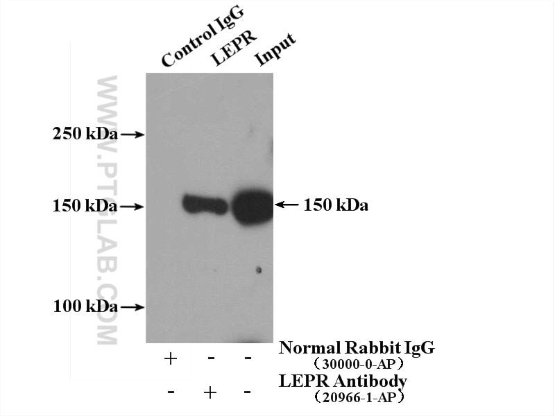 Immunoprecipitation (IP) experiment of mouse heart tissue using LEPR Polyclonal antibody (20966-1-AP)