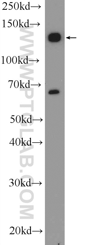 Western Blot (WB) analysis of mouse heart tissue using LEPR Polyclonal antibody (20966-1-AP)