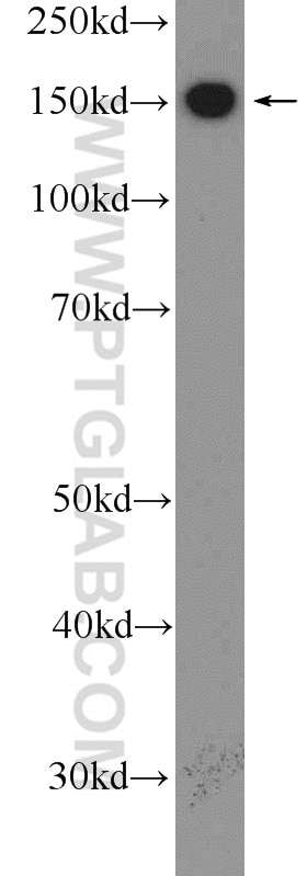 Western Blot (WB) analysis of mouse heart tissue using LEPR Polyclonal antibody (20966-1-AP)