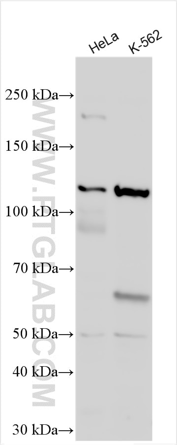Western Blot (WB) analysis of various lysates using LEPR Polyclonal antibody (20966-1-AP)
