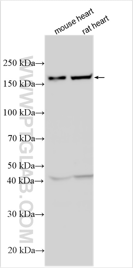Western Blot (WB) analysis of various lysates using LEPR Polyclonal antibody (32817-1-AP)