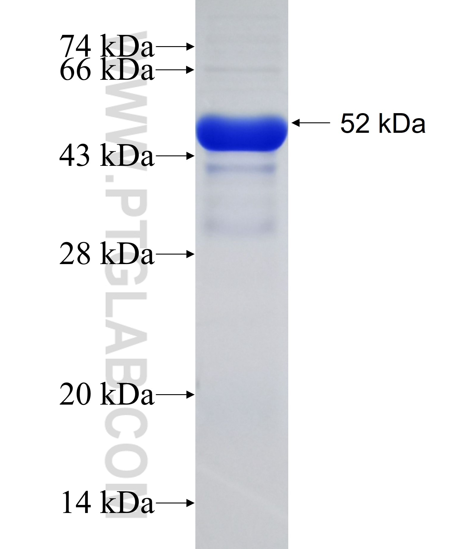LEPR fusion protein Ag29331 SDS-PAGE LEPR fusion protein Ag29331 SDS-PAGE