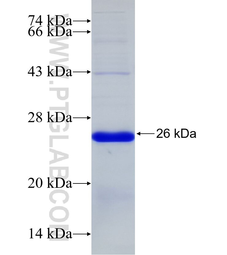 LEPR fusion protein Ag32746 SDS-PAGE LEPR fusion protein Ag32746 SDS-PAGE