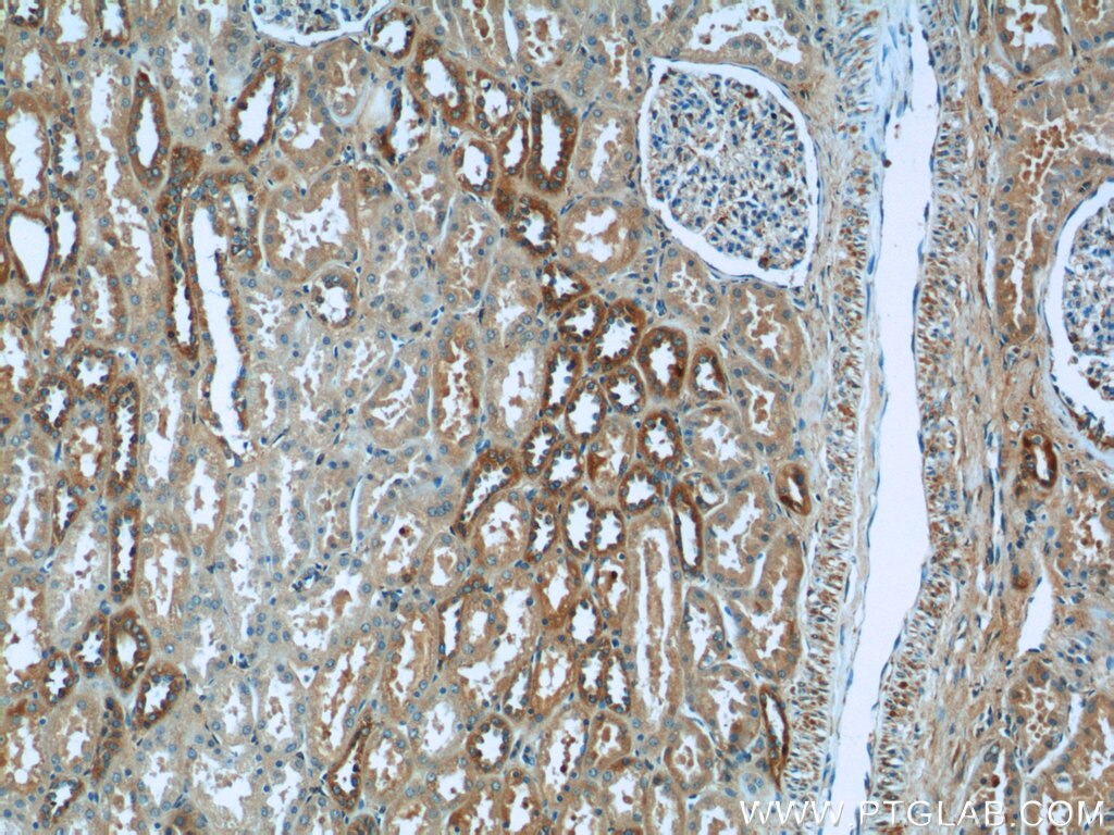 Immunohistochemistry (IHC) staining of human kidney tissue using P3H2 Polyclonal antibody (15723-1-AP)