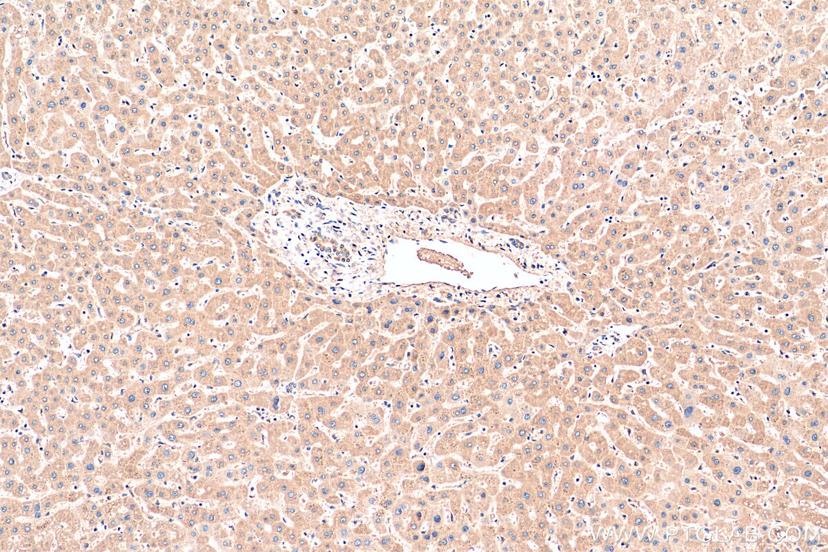 Immunohistochemistry (IHC) staining of human liver tissue using P3H2 Polyclonal antibody (15723-1-AP)