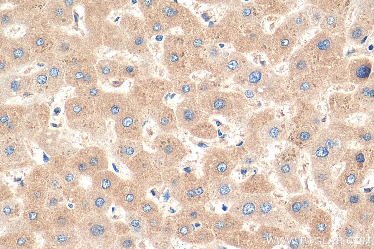 Immunohistochemistry (IHC) staining of human liver tissue using P3H2 Polyclonal antibody (15723-1-AP)