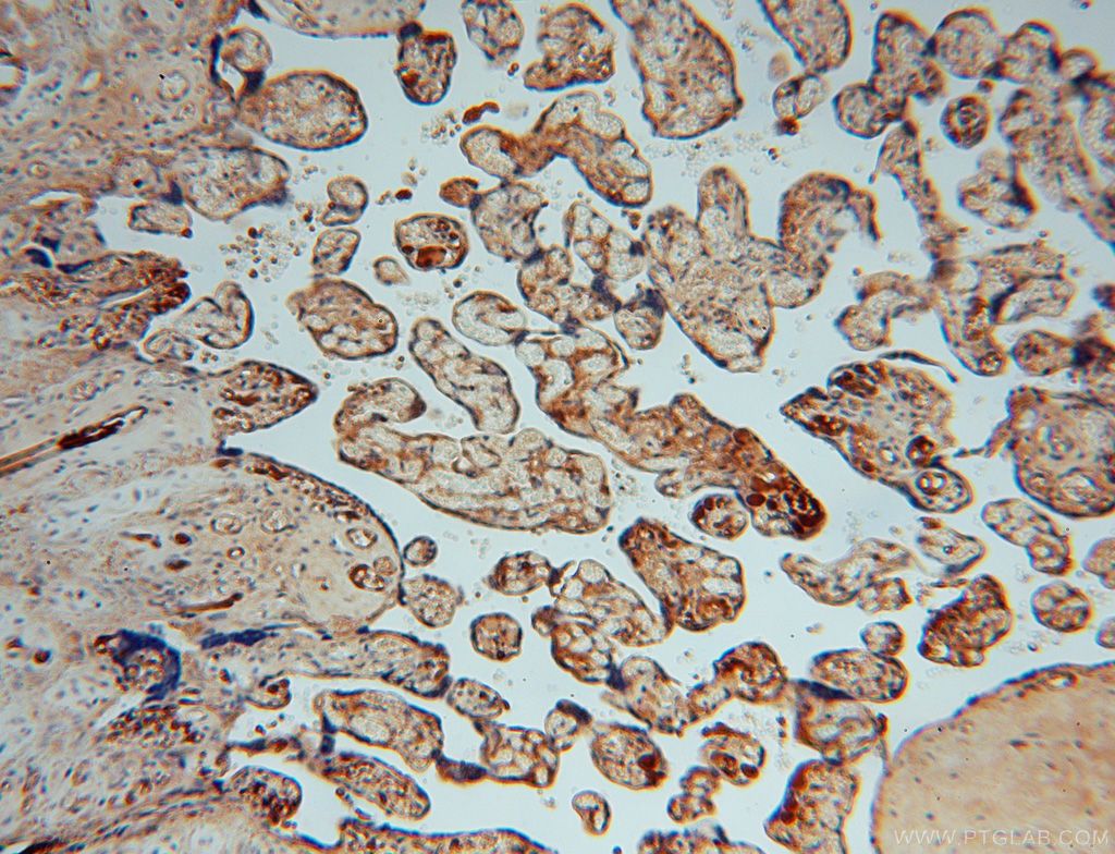 Immunohistochemistry (IHC) staining of human placenta tissue using P3H2 Polyclonal antibody (15723-1-AP)