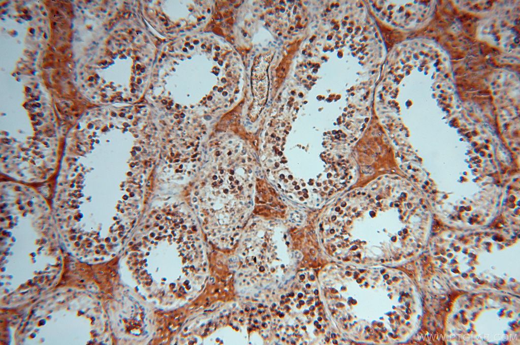 Immunohistochemistry (IHC) staining of human testis tissue using P3H2 Polyclonal antibody (15723-1-AP)