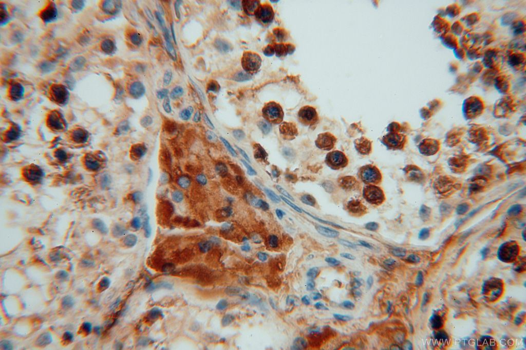 Immunohistochemistry (IHC) staining of human testis tissue using P3H2 Polyclonal antibody (15723-1-AP)